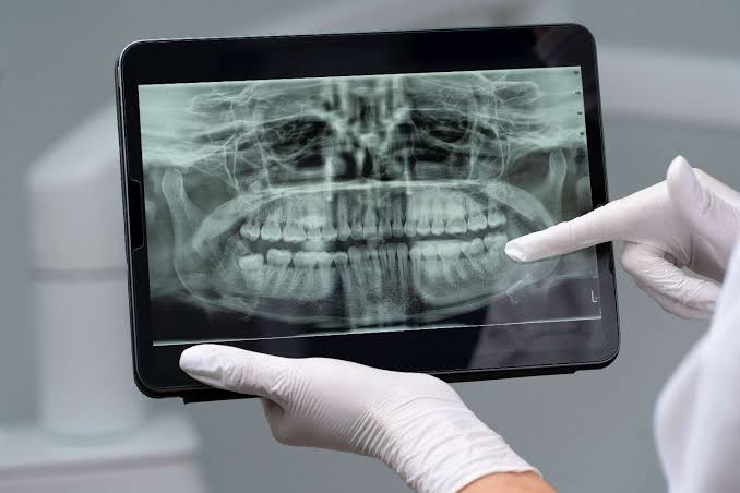 Digital Dental Imaging & 3D Scanning
